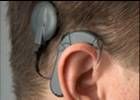 Hinter dem Ohr liegender Außenteil, der wie ein Hörgerät getragen wird.